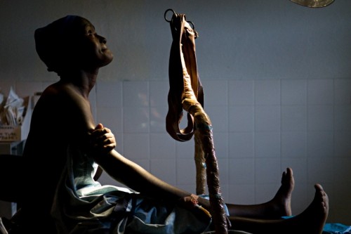 RAPE WEAPON OF WAR IN DRC
